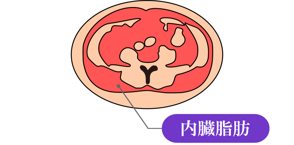 【内臓脂肪と皮下脂肪の見分け方】増えすぎるとそれぞれ危険な病気へ！