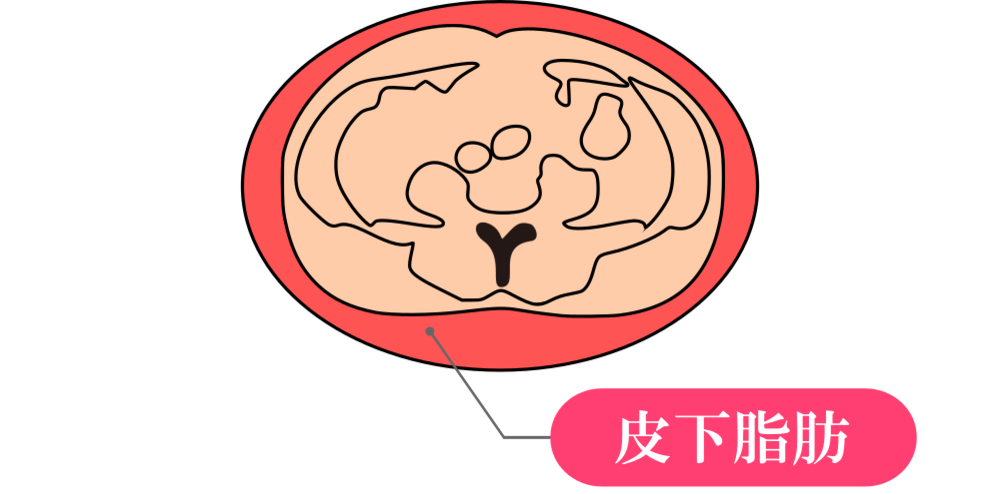 【内臓脂肪と皮下脂肪の見分け方】増えすぎるとそれぞれ危険な病気へ！