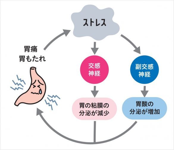 あなたは大丈夫？胃とメンタルには深〜い関係が…“無意識ストレス負債”を今すぐチェック