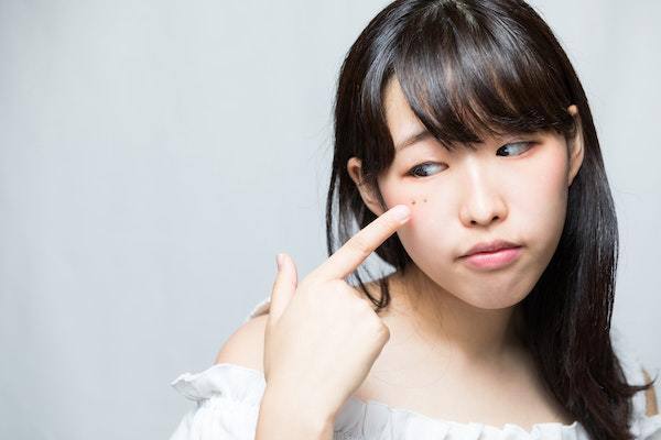 美人は顔にほくろが多い？モテ度アップの魅力的なほくろを徹底解説