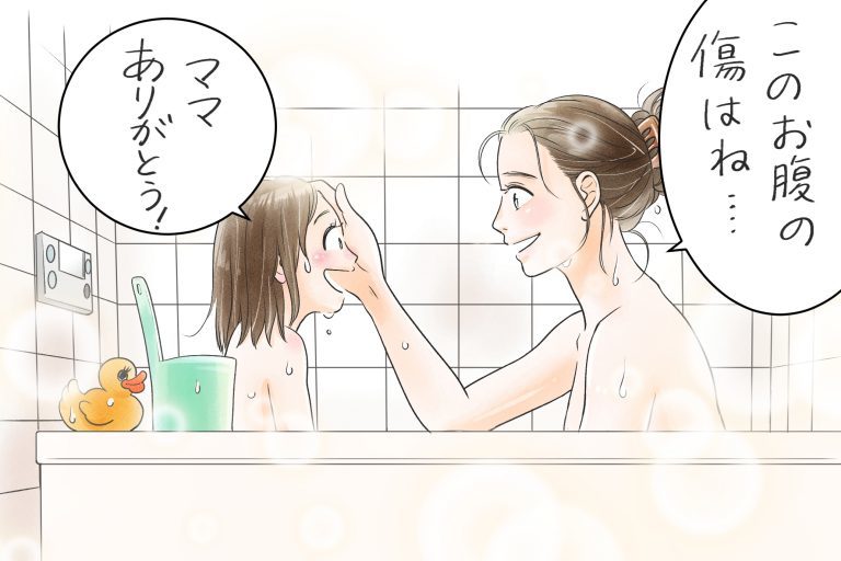 帝王切開への“モヤモヤ感”を取り払ってくれた“娘の一言”。お風呂で「ママ…」